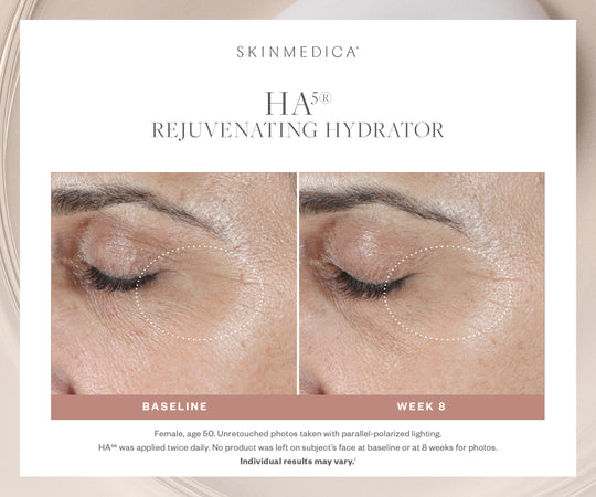 SkinMedica HA5® Rejuvenating Hydrator