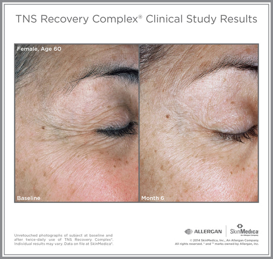 TNS Recovery Complex®